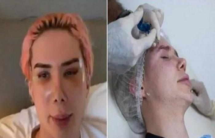 مهووس يجري 18 عملية تجميل ليشبه مغني شهير