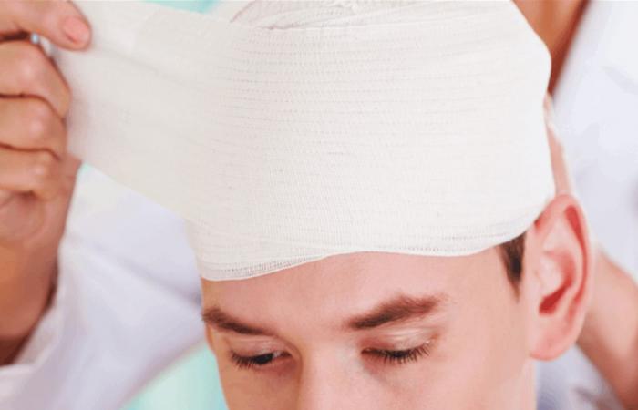 إصابات الرأس.. أعراض تستلزم الرعاية الطبية الطارئة