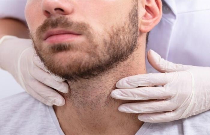 طبيب يجذر من تضخم الغدد اللمفاوية