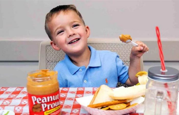 علاج مبتكر للأطفال المصابين بحساسية الفول السوداني... دراسة تكشف