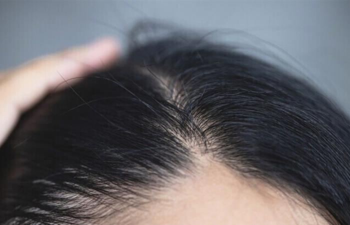 طبيبة تكشف عن مكون بسيط في المطبخ يعالج مشكلات فروة الرأس