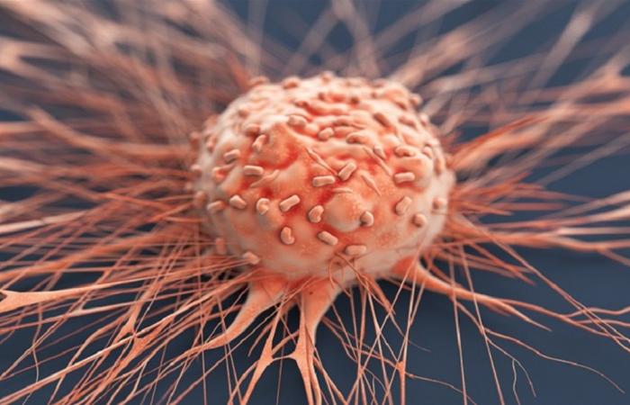 5 عادات شائعة قد تزيد خطر الإصابة بالسرطان