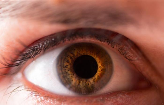 احذر… هذا ما سيحدث لعينيك في حال كنت تعاني من نقص هذا المعدن