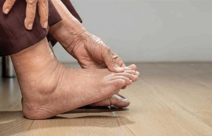 على ماذا يدل تورم الكاحل؟