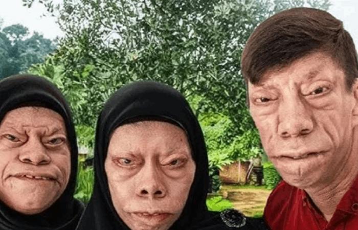 بالفيديو.. عائلة إندونيسية تتحول وجوهها إلى "سحالي"