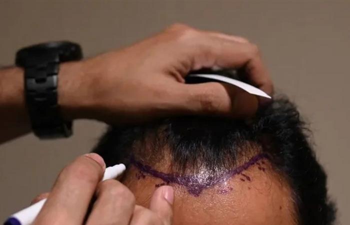 بالفيديو.. فنان معروف يكشف سر حلاقة شعره