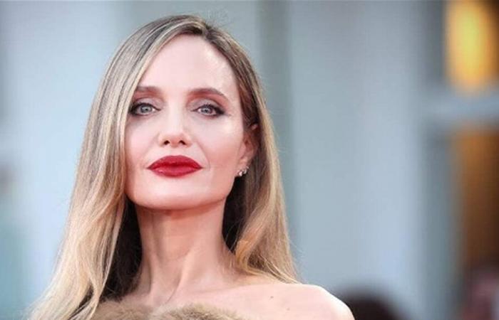 بعد حادث خطير... ندوب على وجه باكس جولي بيت في أول ظهور له