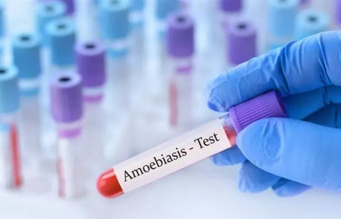 نسبة الوفاة مرتفعة جدّاً... تحذير من "الأميبا الآكلة للدماغ"