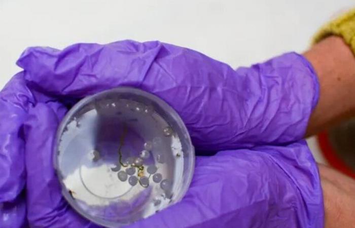 دراسة تكشف مُفاجأة طبية.. العثور على بلاستيك في أنسجة بشرية!