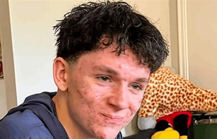 تجاهل نصيحة والده.. مراهق فقد حياته بسبب الخوذة