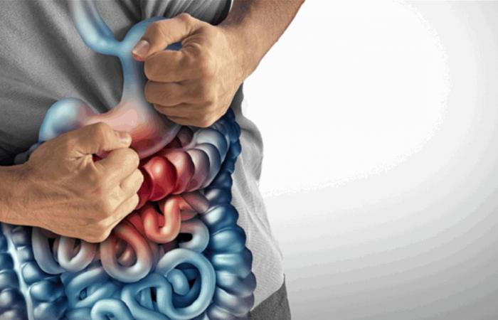 بشرى لمرضى كرون.. اكتشاف قد ينهي المعاناة من أكثر المضاعفات صعوبة في العلاج