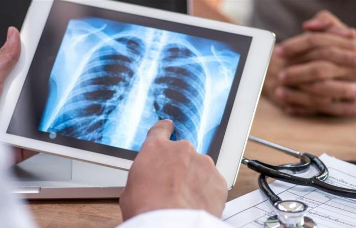 تطور علمي لافت.. جهاز جديد يكشف الالتهاب الرئوي في دقائق