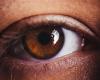 دراسة تربط بين مرض في العين وخطر أمراض القلب